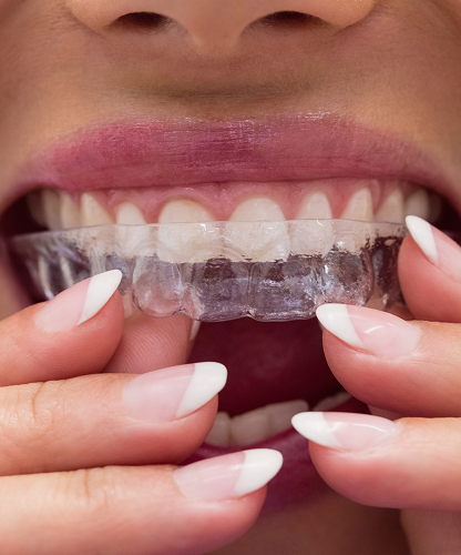 female-patient-wearing-braces 2